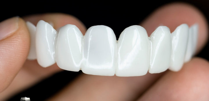 Kalsten | Cosmetic Tooth Toppers SmileShape – Reusable, Flexible and Naturally White