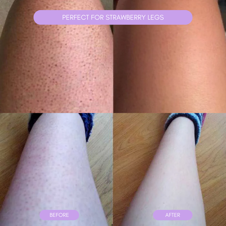 Hair Removal Device for Smooth Skin Kalsten