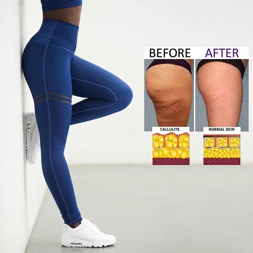 Kalsten | Women's Anti-cellulite Compression Leggings