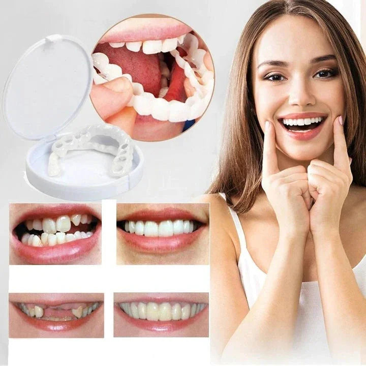 Kalsten | Instant Smile Transformation with Snap on Smile Veneers