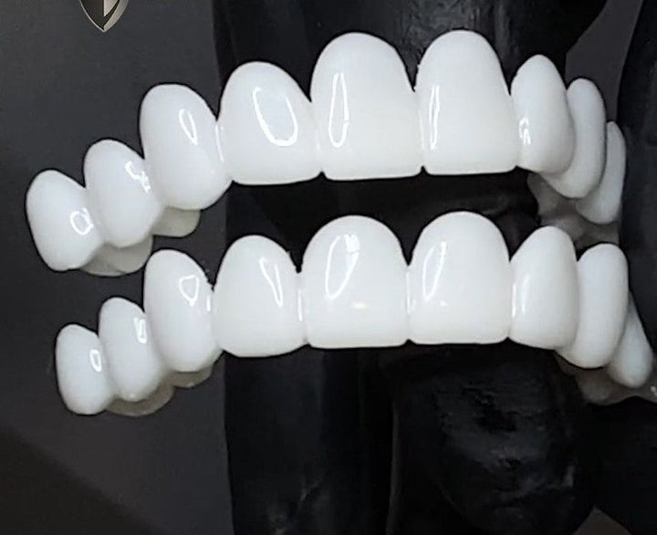Kalsten | Cosmetic Tooth Toppers SmileShape – Reusable, Flexible and Naturally White