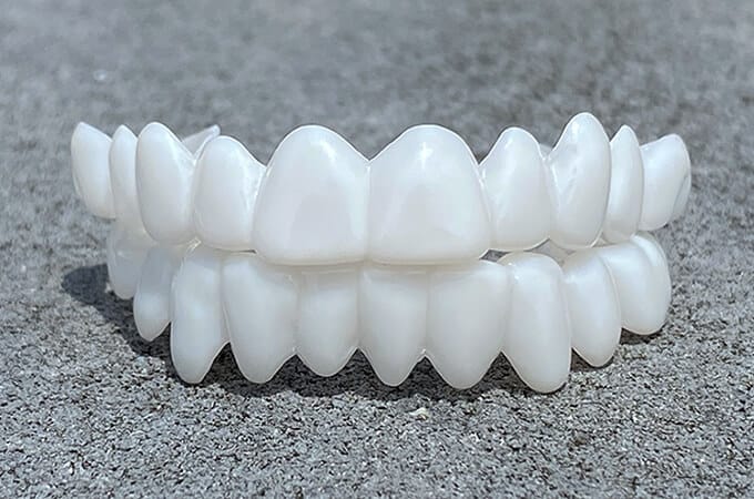 Kalsten | Cosmetic Tooth Toppers SmileShape – Reusable, Flexible and Naturally White
