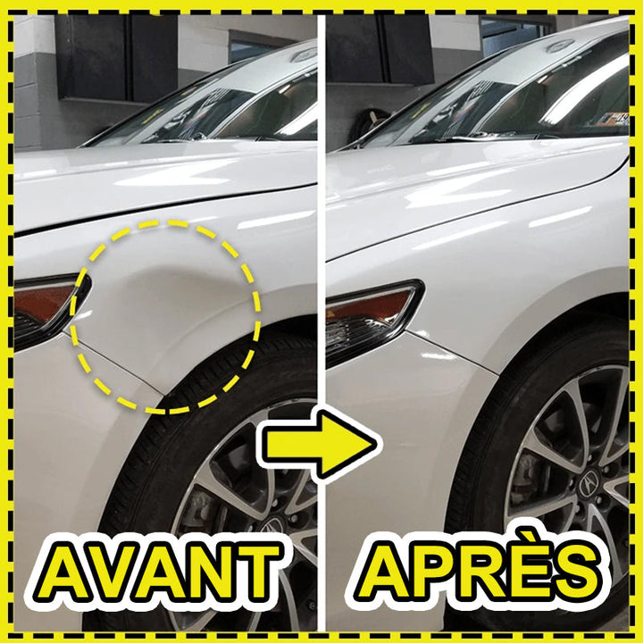 Mini car dent repair extractor | Kalsten