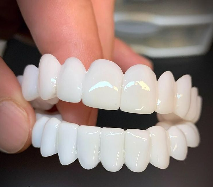 Kalsten | Cosmetic Tooth Toppers SmileShape – Reusable, Flexible and Naturally White