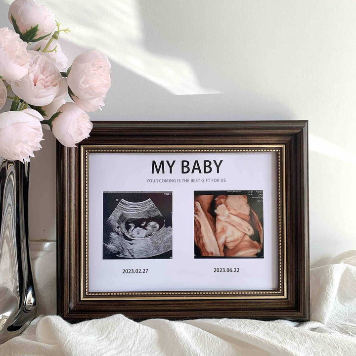 Personalized Ultrasound Photo Frame for Home Display