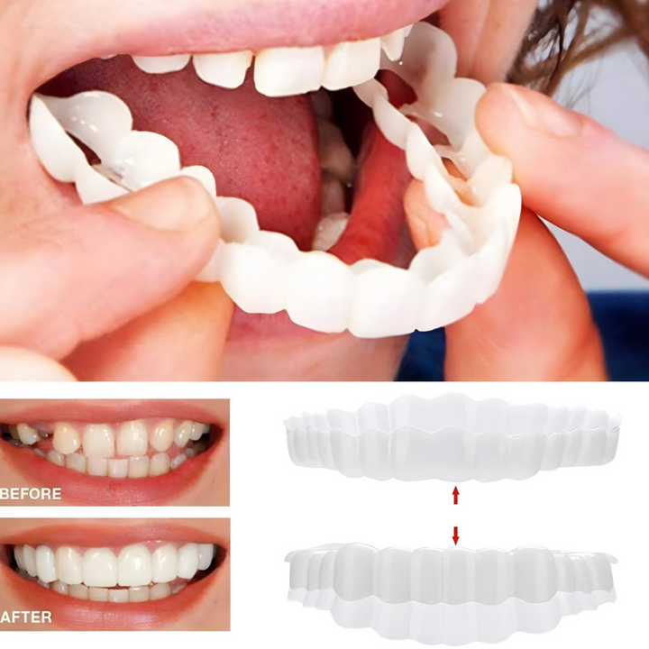 Removable Fillings Tooth Cover Kalsten