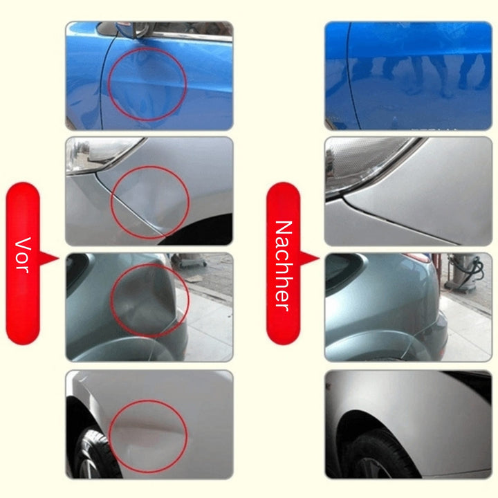 DeukFix Repair Set – Car Dents Removal Without Paint Damage | Kalsten