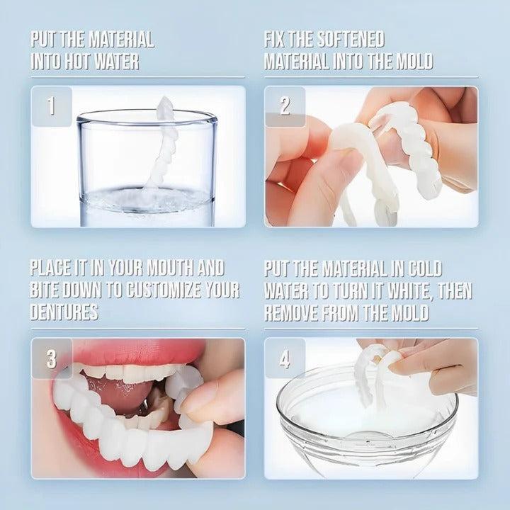 Kalsten | Removable Smile Veneers for Upper and Lower Teeth