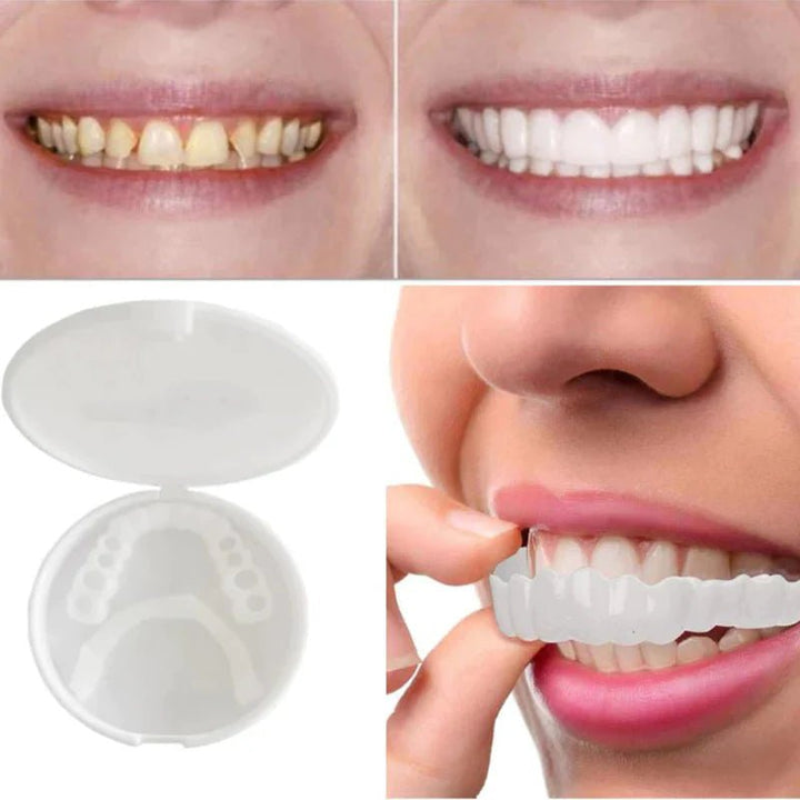 Kalsten | SnapFit Dental Restoration – Perfect Smile Without Dentist Visits